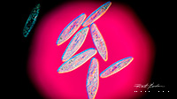 Paramecium caudatum DIC microscopy 100X by Robert Berdan