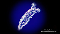 Bedelloid rotifer Darkfield microscope 100X by Robert Berdan 