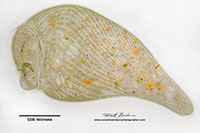Stentor coreuleus bright field microscopy by Robert Berdan ©