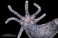 Brown Hydra by Darkfield microscopy by Robert Berdan ©