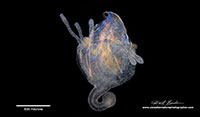 Hydra injesting Daphnia Darkfield microscopy by Robert Berdan ©