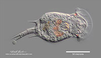 Squatinella rostrum (Rotifera: Monogononta, Ploima, Lepadellidae) rotifer by Robert Bedan ©