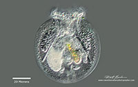 Testudinella patina - nicknamed Turtle Rotifer by Robert Berdan ©