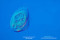 Ciliate Euplotidae? DIC microscopy by Robert Berdan ©