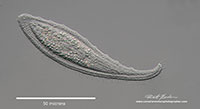 Loxophyllum helus is a common elongated ciliate by Robert Berdan ©