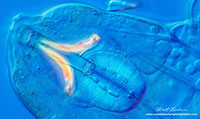 Tardigrade High magnification picture showing the Buccal - Pharyngeal bulb, 2 stylets, 3 sets of macroplacoids and 2 smaller microplacoids DIC microscopy 800X by Robert Berdan ©