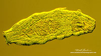 Water bear Tardigrade Combination DIC and Rheinberg lighting of Water bear 200X produces a golden colour by Robert Berdan ©