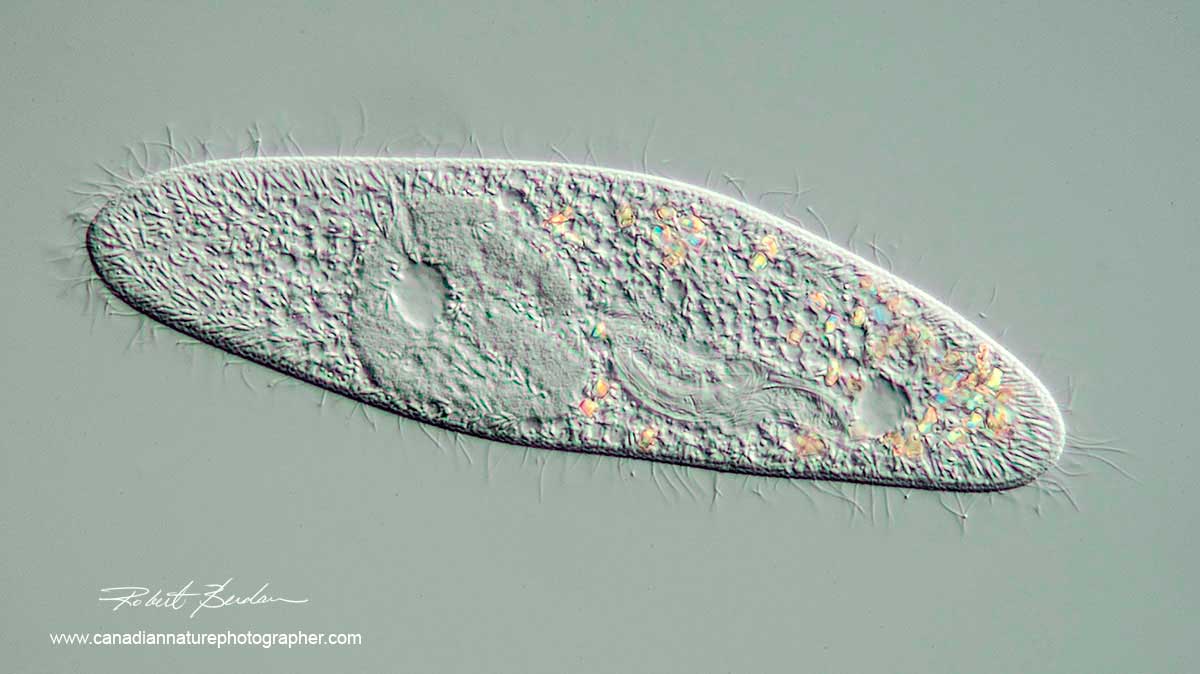 Paraemcium by DIC microscopy by Robert Berdan ©