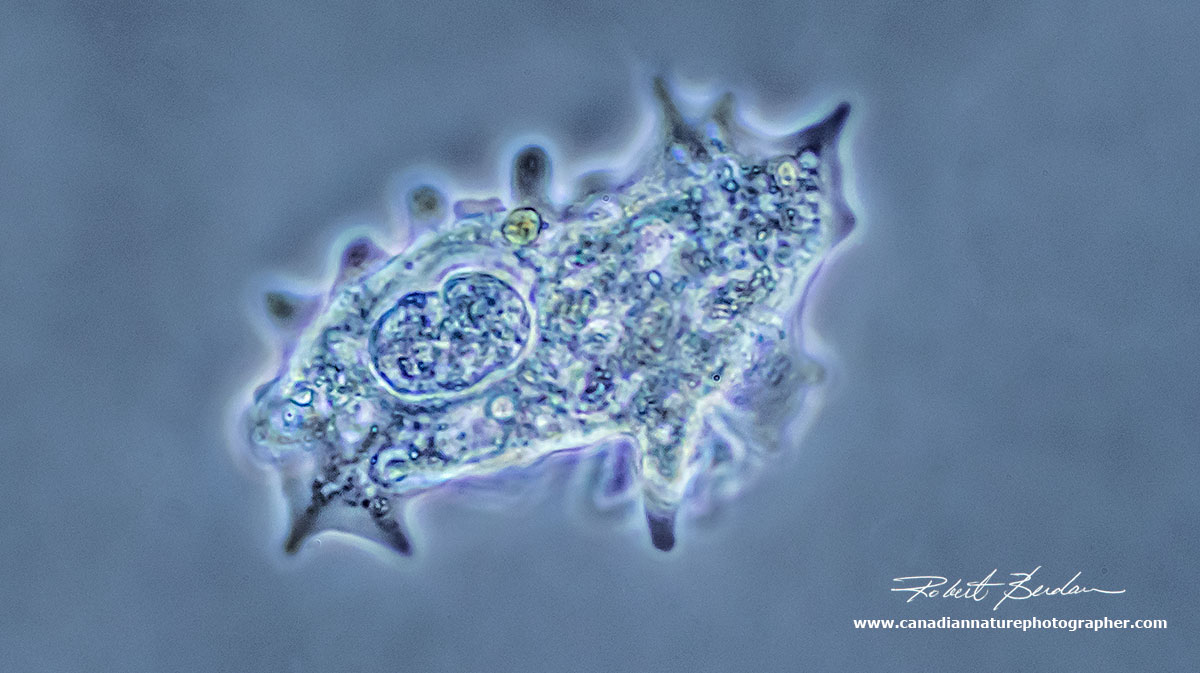 Amoeba by phase contrast microscopy by Robert Berdan ©