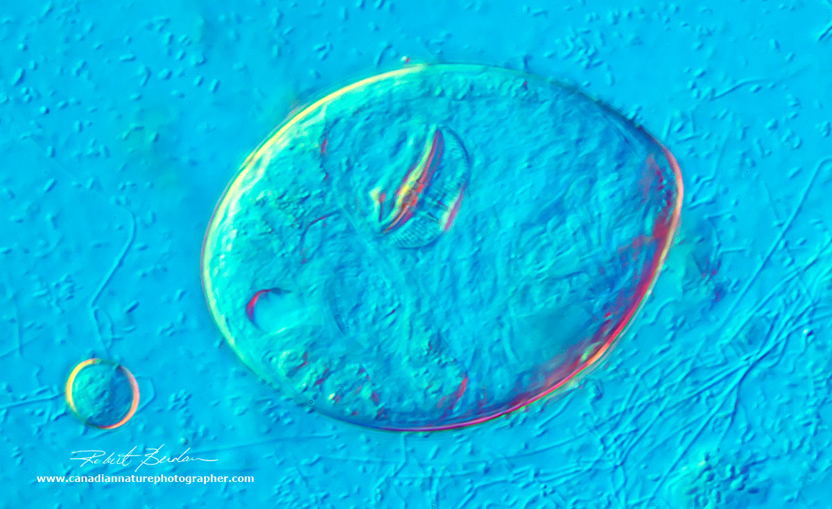 Rotifer cyst DIC microscopy 400X by Robert Berdan ©