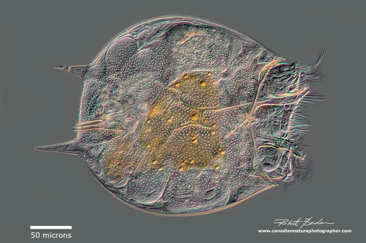 Platyias quadracornis - 200X DIC microscopy - focus stack Robert Berdan ©