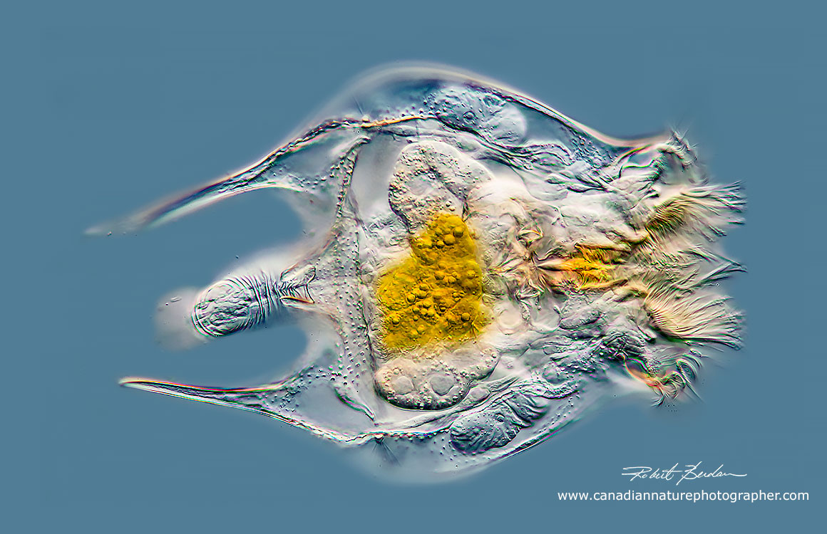 Brachionus quadridentatus DIC microscopy 200X  Robert Berdan ©