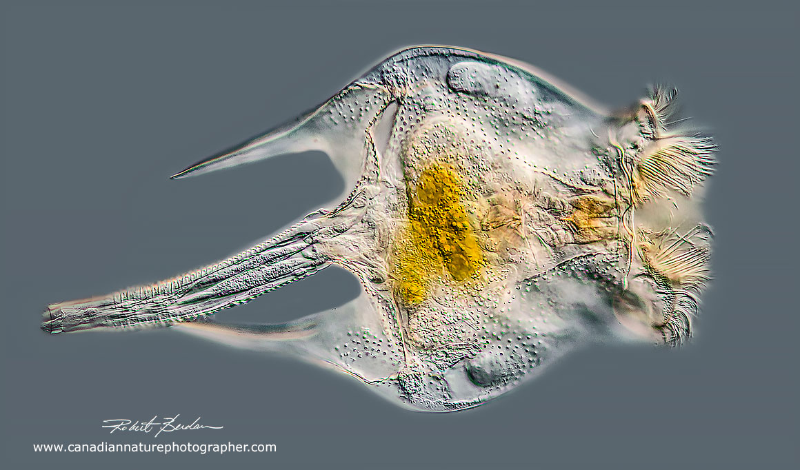 Brachionus quadridentatus DIC microscopy 200X  Robert Berdan ©