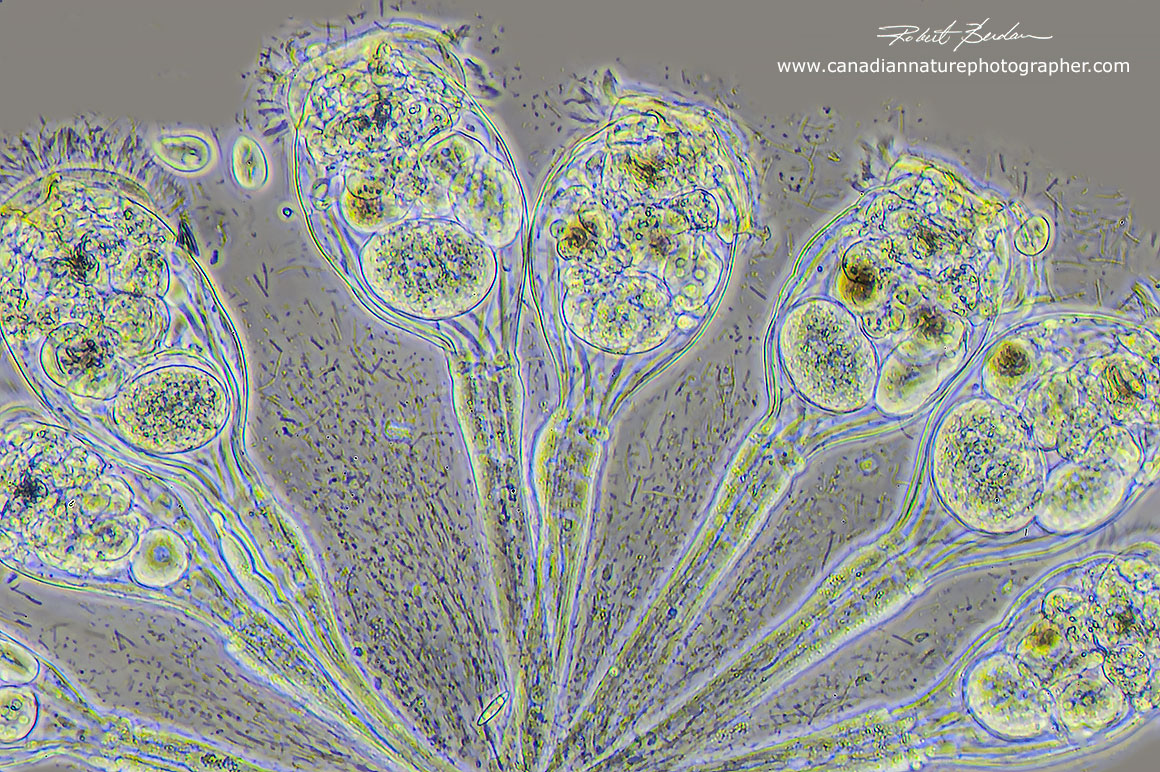 Conochilus hippocrepis phase contrast microscopy 400X Robert Berdan ©